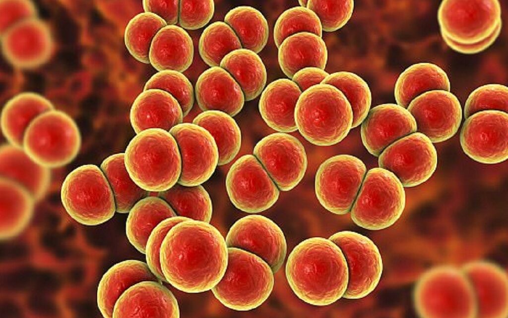 Bệnh lậu là một trong các loại bệnh xã hội gây ra bởi song cầu khuẩn có tên Neisseria Gonorrhoeae.